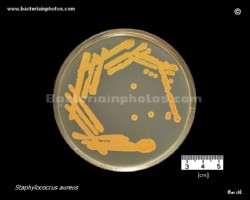 s.aureus culture on brain heart agar